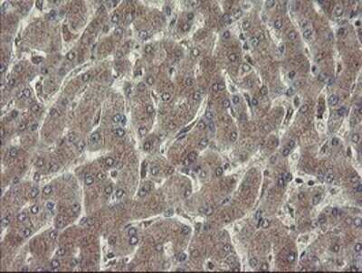 Immunohistochemistry: Ribophorin I Antibody (OTI5B1) - Azide and BSA Free [NBP2-73905]