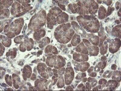 Immunohistochemistry: Ribophorin I Antibody (OTI5B1) - Azide and BSA Free [NBP2-73905]