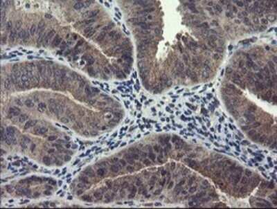 Immunohistochemistry: Ribophorin I Antibody (OTI5B1) [NBP2-45633]