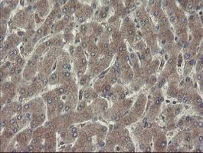 Immunohistochemistry: Ribophorin I Antibody (OTI5B1) [NBP2-45633]