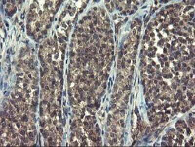 Immunohistochemistry: Ribophorin I Antibody (OTI5B1) [NBP2-45633]