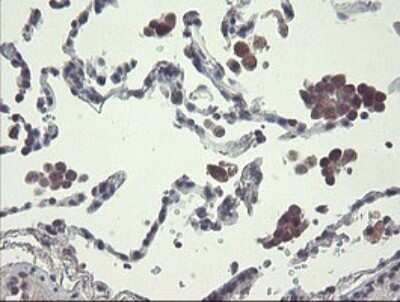 Immunohistochemistry: Ribophorin I Antibody (OTI5B1) [NBP2-45633]