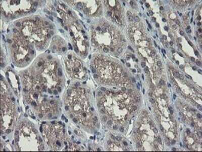 Immunohistochemistry: Ribophorin I Antibody (OTI5B1) [NBP2-45633]