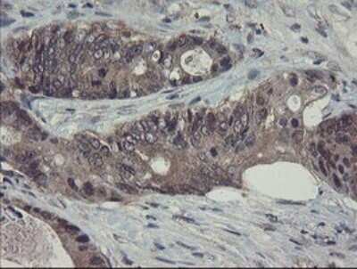 Immunohistochemistry: Ribophorin I Antibody (OTI5B1) [NBP2-45633]