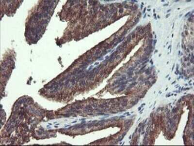 Immunohistochemistry: Ribophorin I Antibody (OTI5B1) [NBP2-45633]
