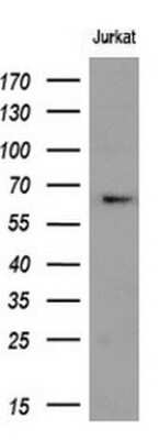 Western Blot: Ribophorin I Antibody (OTI5B1) [NBP2-45633]