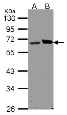 Western Blot: Ribophorin I Antibody [NBP1-32704]