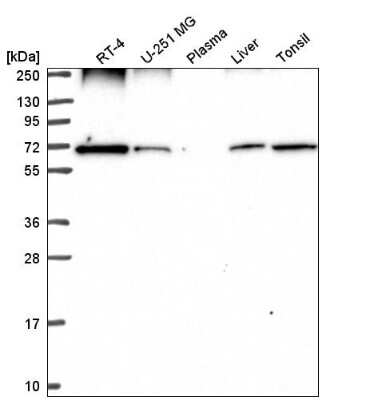 Western Blot: Ribophorin I Antibody [NBP2-55523]