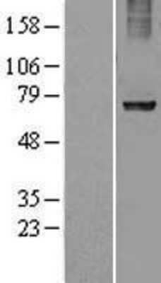 Western Blot: Ribophorin I Overexpression Lysate [NBL1-15550]