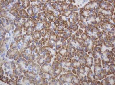 Immunohistochemistry: Ribophorin II Antibody (OTI1G9) [NBP2-45963]