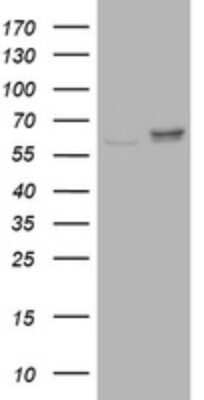 Western Blot: Ribophorin II Antibody (OTI1G9) [NBP2-45963]