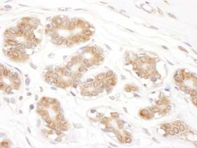 Immunohistochemistry: Ribophorin II Antibody [NBP2-32178]
