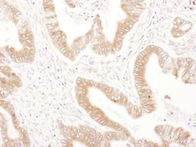 Immunohistochemistry: Ribophorin II Antibody [NBP2-32178]
