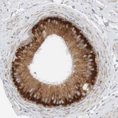 Immunohistochemistry-Paraffin: Ribophorin II Antibody [NBP1-80835]