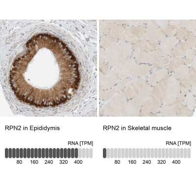 Immunohistochemistry-Paraffin: Ribophorin II Antibody [NBP1-80835]