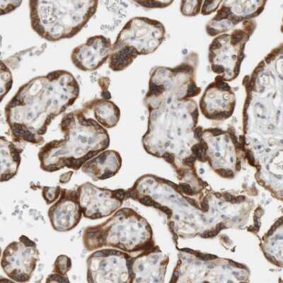 Immunohistochemistry-Paraffin: Ribophorin II Antibody [NBP1-80835]