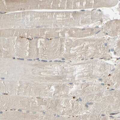 Immunohistochemistry-Paraffin: Ribophorin II Antibody [NBP1-80836]