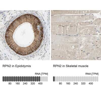 Immunohistochemistry-Paraffin: Ribophorin II Antibody [NBP1-80836]