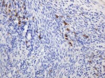 Immunohistochemistry: Ribophorin II Antibody (OTI1G9) - Azide and BSA Free [NBP2-73907]