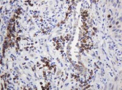 Immunohistochemistry: Ribophorin II Antibody (OTI1G9) - Azide and BSA Free [NBP2-73907]