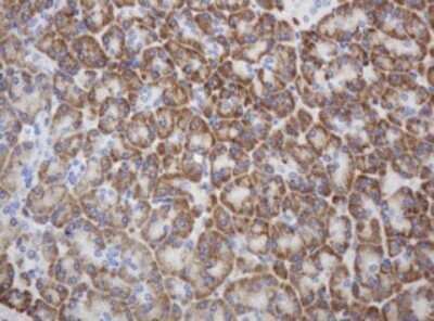 Immunohistochemistry: Ribophorin II Antibody (OTI1G9) - Azide and BSA Free [NBP2-73907]