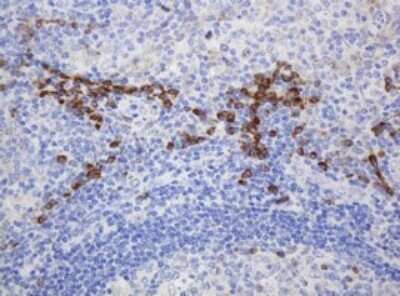Immunohistochemistry: Ribophorin II Antibody (OTI1G9) - Azide and BSA Free [NBP2-73907]