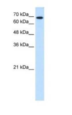 Western Blot: Ribophorin II Antibody [NBP1-62480]