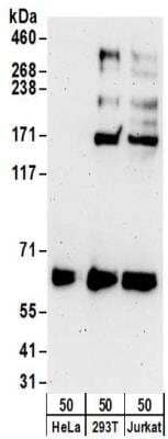 Western Blot: Ribophorin II Antibody [NBP2-32178]