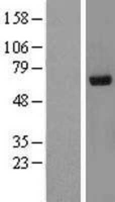 Western Blot: Ribophorin II Overexpression Lysate [NBL1-15551]