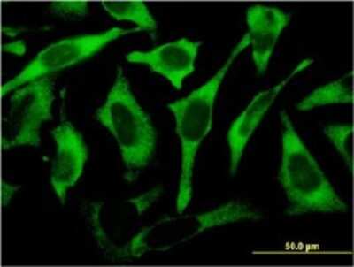 Immunocytochemistry/ Immunofluorescence: Ribosomal Protein L17 Antibody (3G11) [H00006139-M01]