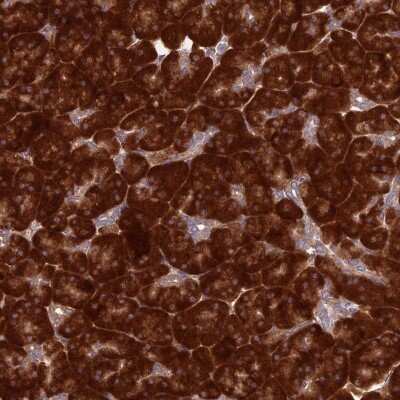 Immunohistochemistry: Ribosomal Protein L17 Antibody [NBP2-48798]