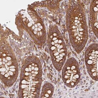 Immunohistochemistry: Ribosomal Protein L24 Antibody [NBP2-33622]