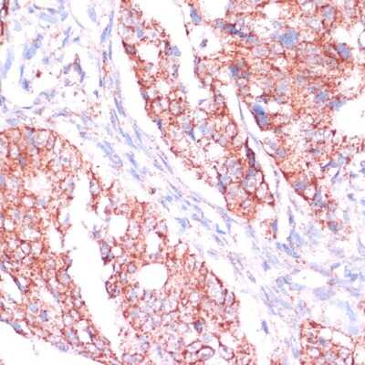 Immunohistochemistry-Paraffin: Ribosomal Protein L24 Antibody - Azide and BSA Free [NBP2-93788]
