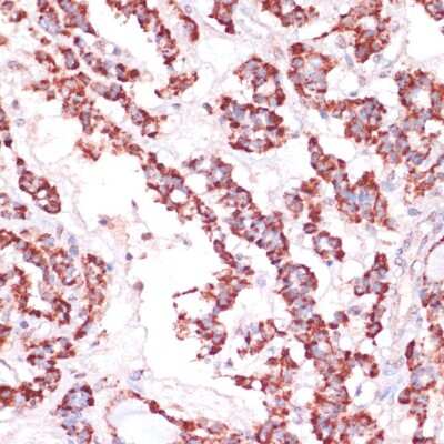 Immunohistochemistry-Paraffin: Ribosomal Protein L24 Antibody - Azide and BSA Free [NBP2-93788]