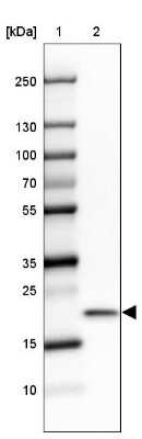 Western Blot: Ribosomal Protein L24 Antibody [NBP2-33622]