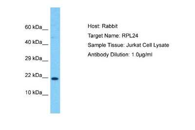 Western Blot: Ribosomal Protein L24 Antibody [NBP2-85636]