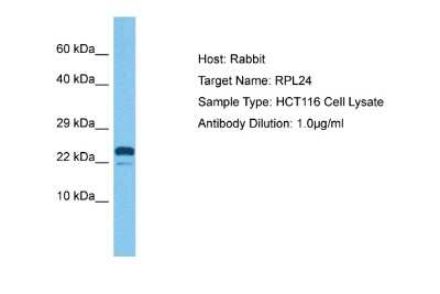 Western Blot: Ribosomal Protein L24 Antibody [NBP2-85636]