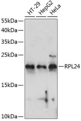 Western Blot: Ribosomal Protein L24 AntibodyAzide and BSA Free [NBP2-93788]