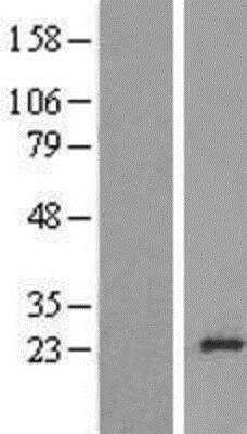 Western Blot: Ribosomal Protein L24 Overexpression Lysate [NBL1-15516]