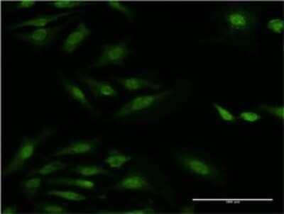 Immunocytochemistry/ Immunofluorescence: Ribosomal Protein S29 Antibody (3G9) [H00006235-M02]