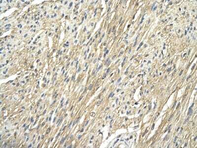 Immunohistochemistry: Ribosomal Protein S29 Antibody [NBP1-57477]