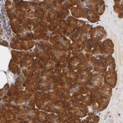 Immunohistochemistry-Paraffin: Ribosomal Protein S29 Antibody [NBP1-80801]