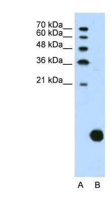 Western Blot: Ribosomal Protein S29 Antibody [NBP1-57477]