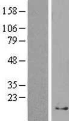 Western Blot: Ribosomal Protein S29 Overexpression Lysate [NBP2-11610]