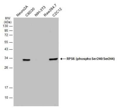 Western Blot: Ribosomal Protein S6/RPS6 [p Ser240, p Ser244] Antibody [NBP3-13315]