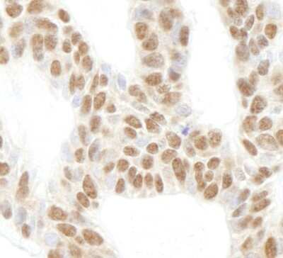 Immunohistochemistry-Paraffin: Ribosomal protein L26 Antibody [NB100-2131]