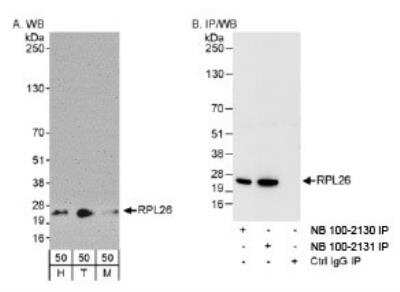 Western Blot: Ribosomal protein L26 Antibody [NB100-2130]