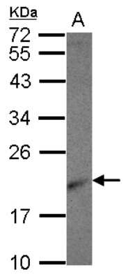 Western Blot: Ribosomal protein L26 Antibody [NBP2-20161]