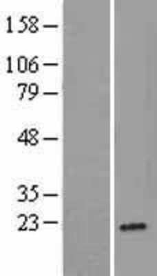 Western Blot: Ribosomal protein L26 Overexpression Lysate [NBL1-15517]