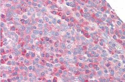 Immunohistochemistry-Paraffin: Ribosomal protein S27 Antibody [NB100-1103]